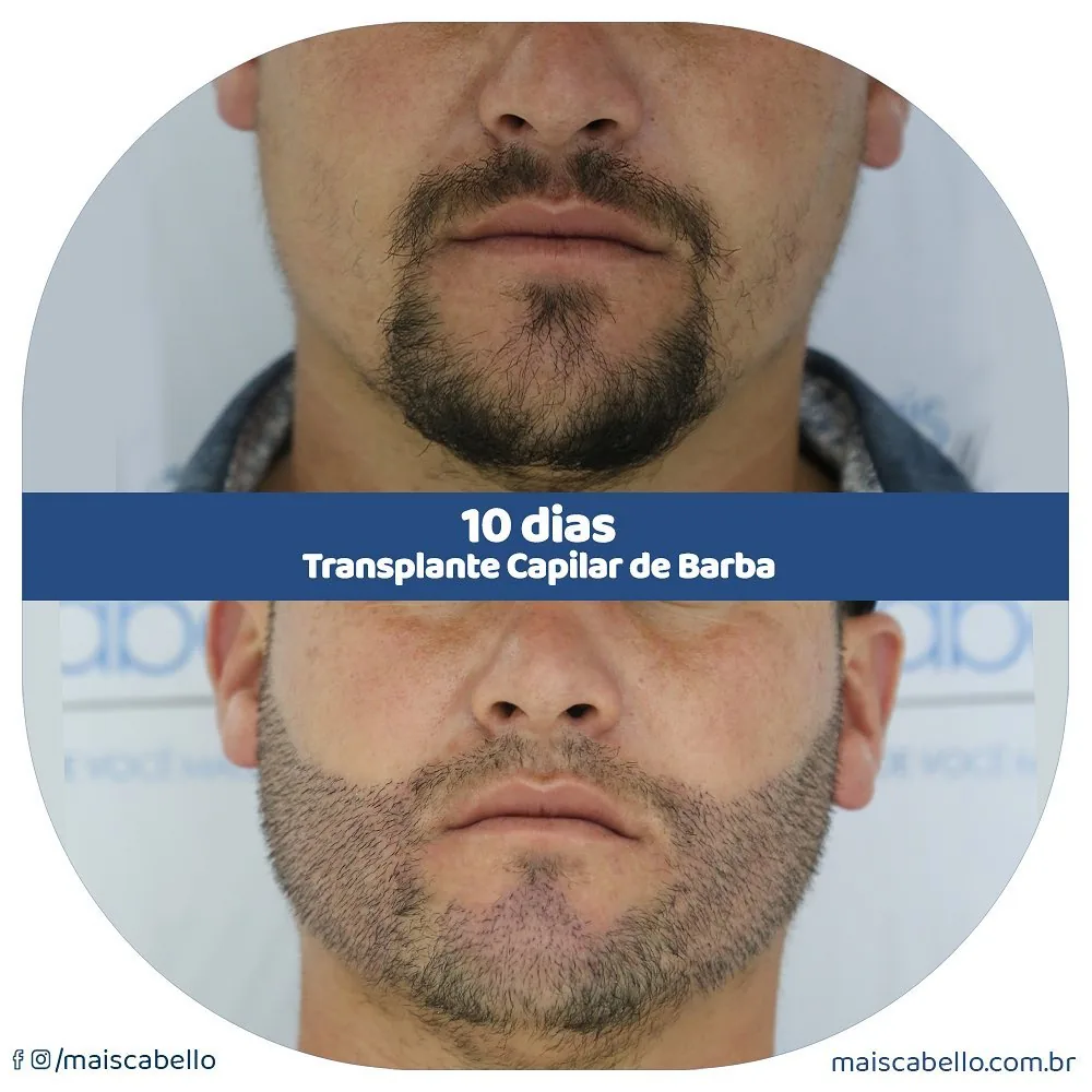 resultado 1