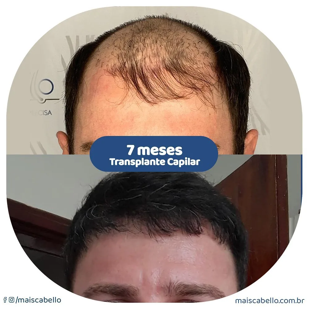 resultado 3
