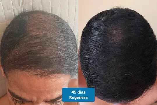 resultado 3